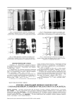 Лечение деформаций нижних конечностей с использованием стержневого чрескостного остеосинтеза