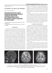 Морфометрическая оценка ликворосодержащих структур головного мозга при внутримозговых кистах различного генеза по данным МР-томографии