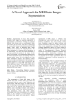 A Novel Approach for MRI Brain Images Segmentation