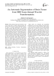 An Automatic Segmentation of Brain Tumor from MRI Scans through Wavelet Transformations