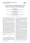 A case analysis on different registration methods on multi-modal brain images