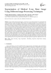 Segmentation of Medical X-ray Bone Image Using Different Image Processing Techniques